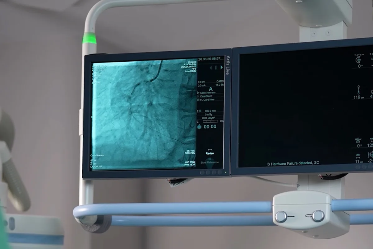 IVL (intravasküler litotripsi) ile kireçli damar tedavisinde anjiyografi monitöründe koroner damar görüntüsü