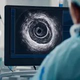 IVUS (damar içi ultrason) konsolunda koroner damarın kesit görüntüsü (temsili görsel)