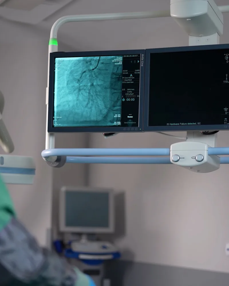 Kireçli damar tedavisi (IVL) sırasında kateter laboratuvarı ve anjiyografi monitörü