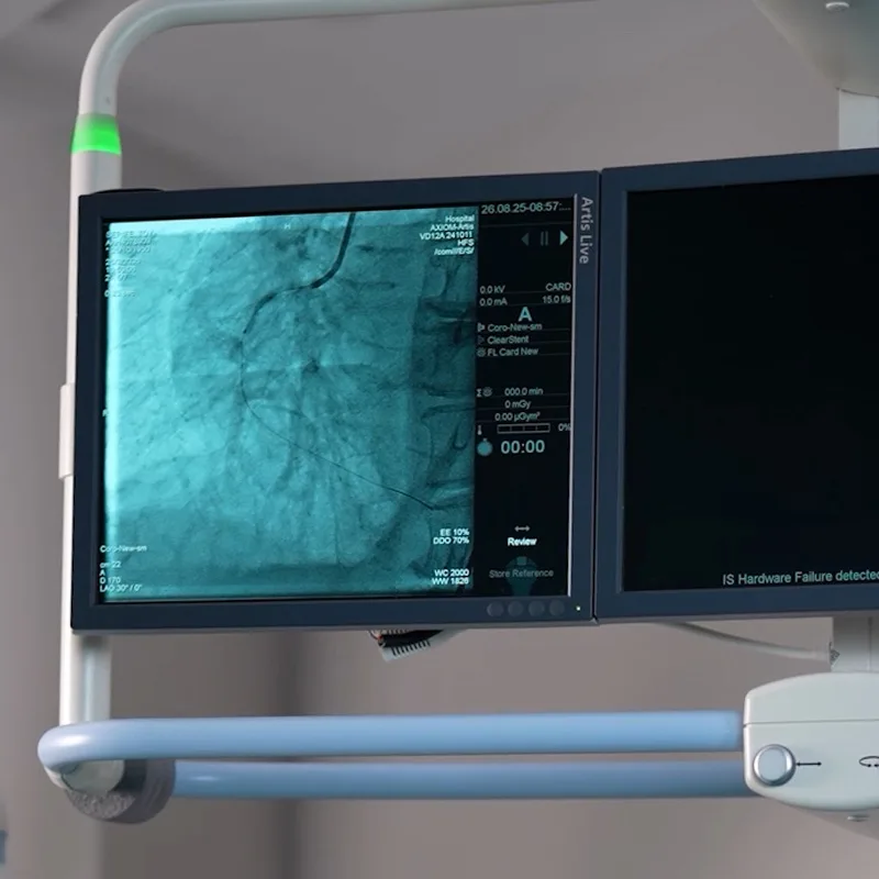Kateter laboratuvarında anjiyografi monitöründe koroner damar görüntüsü